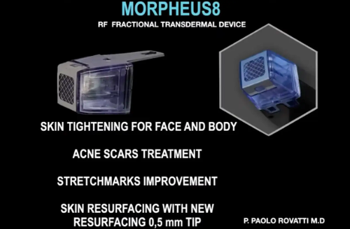 Morpheus8 RF Fractional Transdermal Device | Botoxie in San Diego, CA