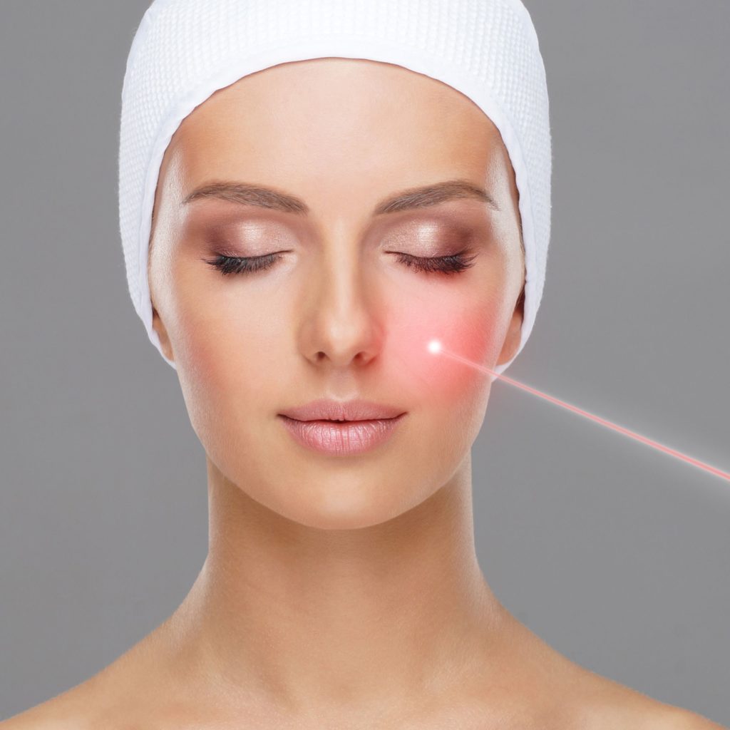 Best Laser Treatments in San Diego, CA