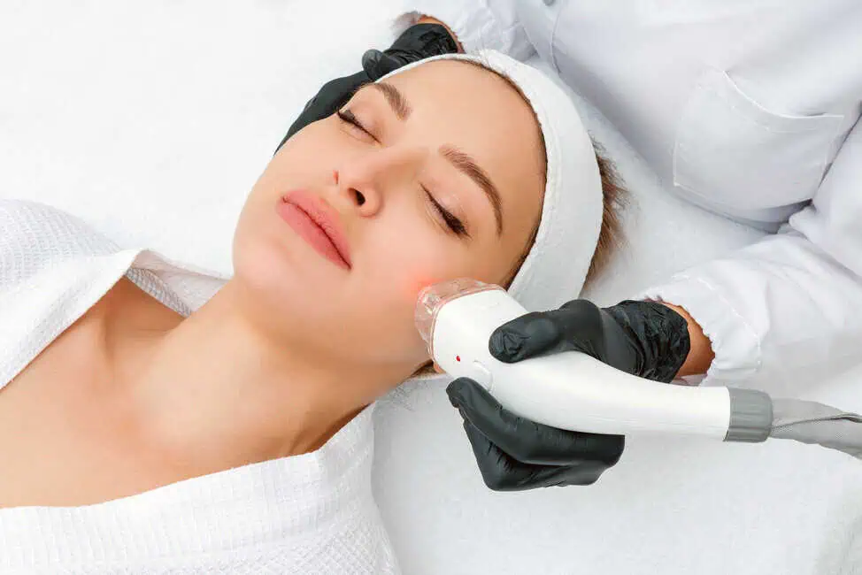 Laser Facials by Botoxie in San Diego, CA