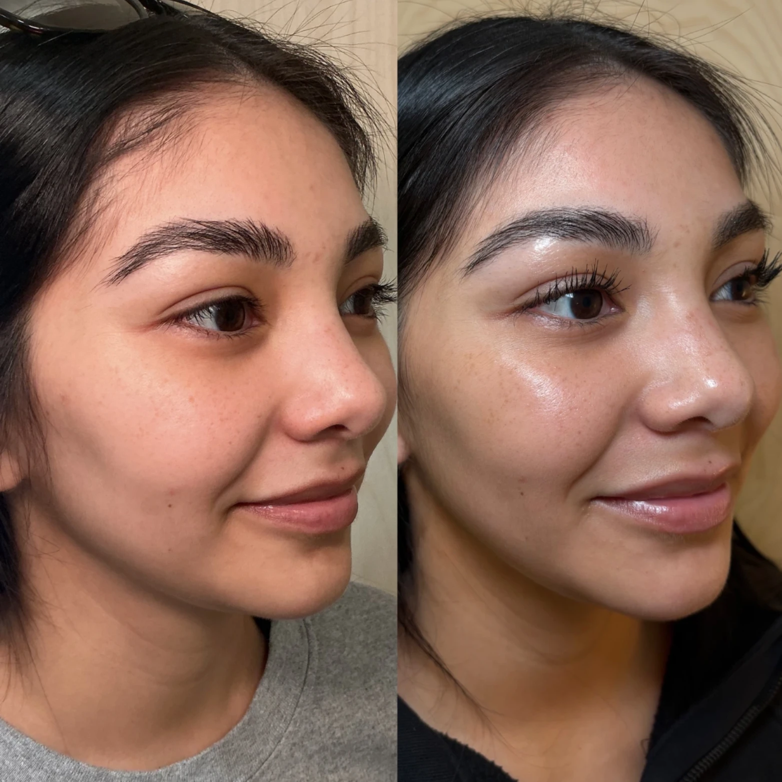 SKIN TONE & TEXTURE