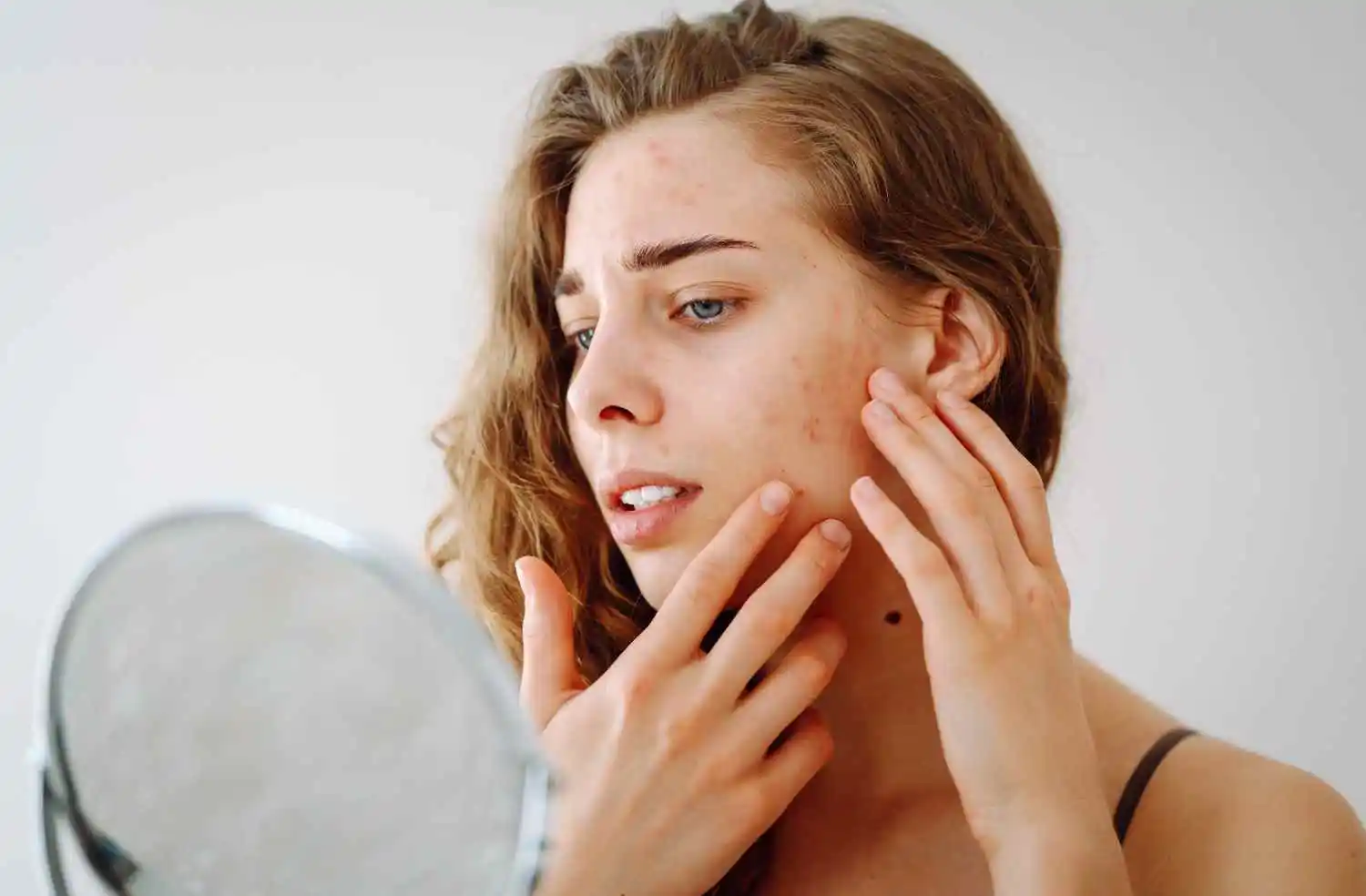 Woman examining blemishes and uneven skin texture on her cheek
